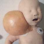 Immagine che descrive la simulazione di un angioma cistico su un manichino ad alta fedeltà rappresentante un neonato